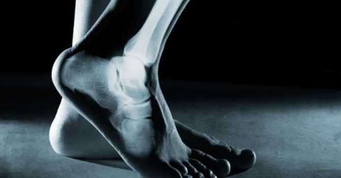 Custom Foot Orthotics: A Natural Choice for Feet image